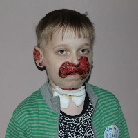 Bambini Kirill M ospedale pediatrico